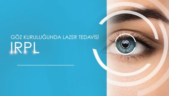 Laserbehandlung für trockene Augen – IRPL