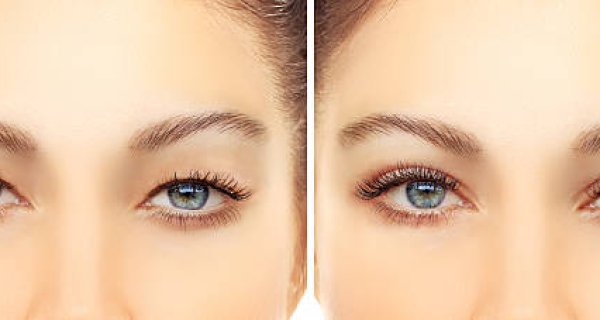 Was verursacht hängende Augenlider (Ptosis)?