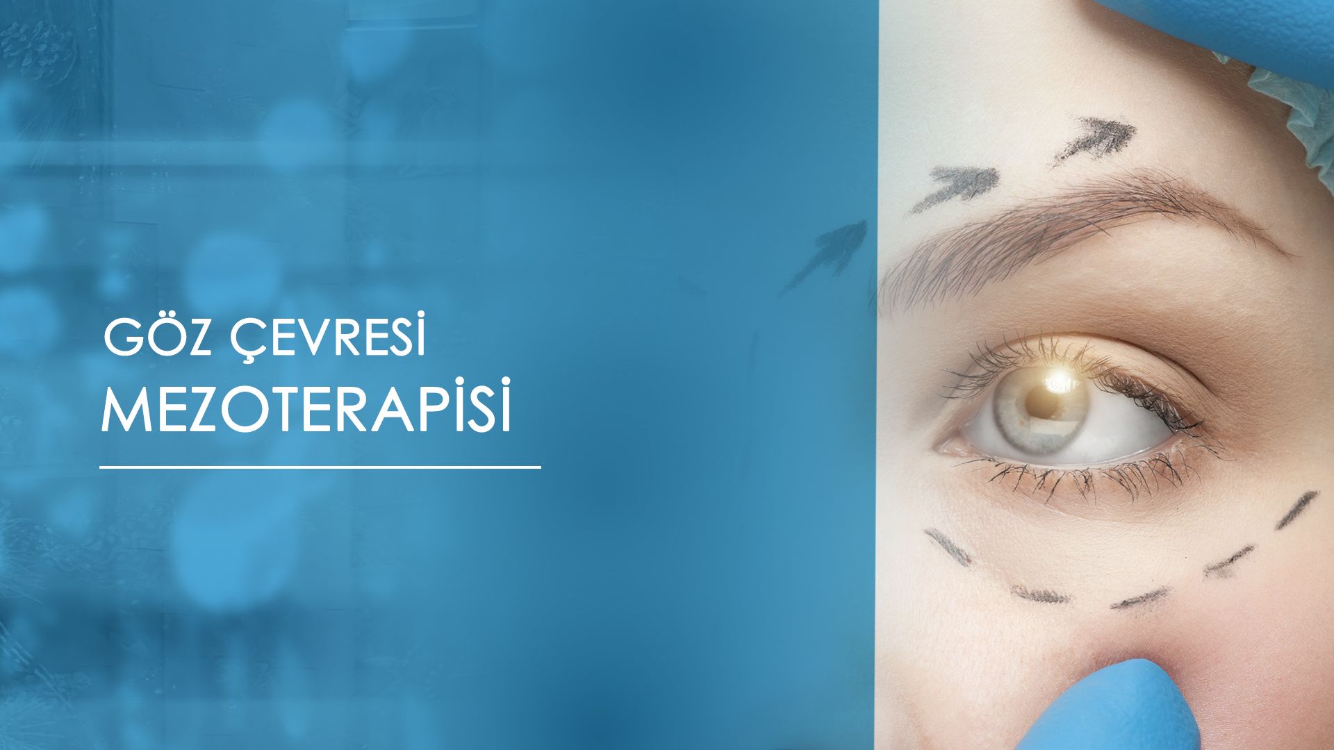 eye-cell-mesotherapy